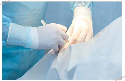 外科手術併用矯正